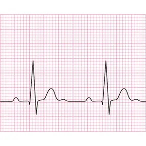 1746878275_ECG Paper.webp
